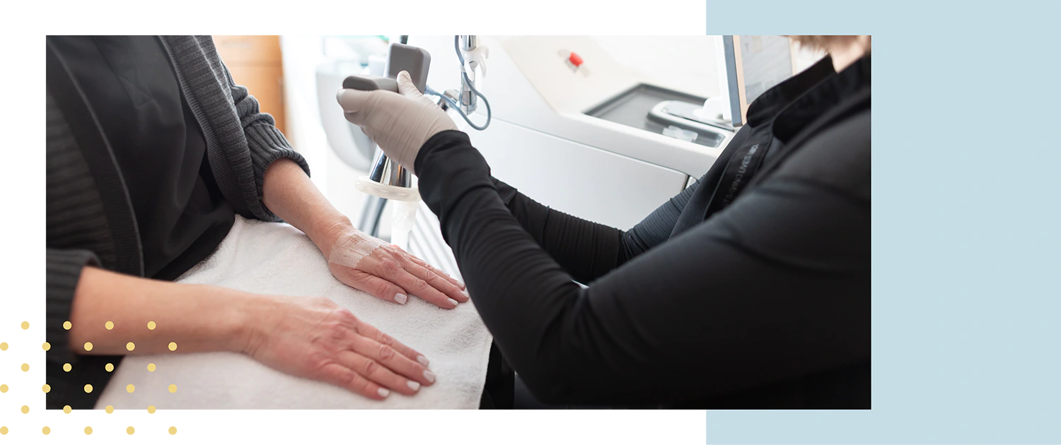 Prepping for a MicroLaserPeel