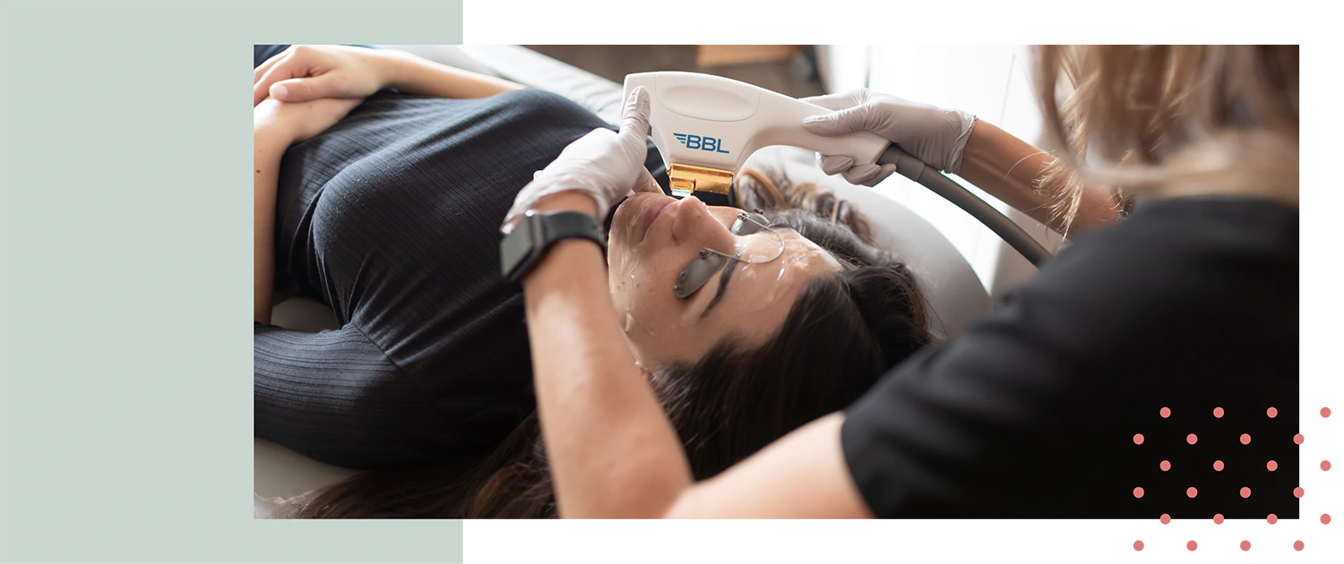 Woman receiving BroadBand Light (BBL) treatment