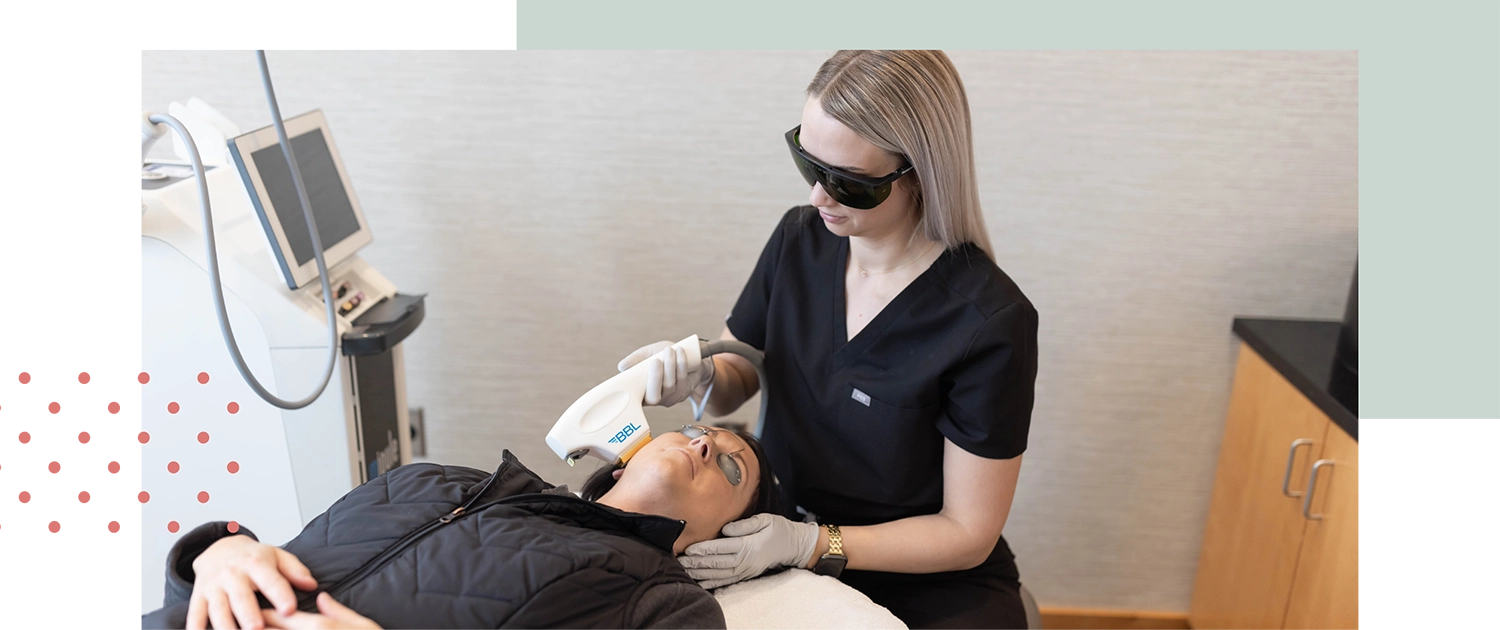 Woman receiving BBL for acne therapy