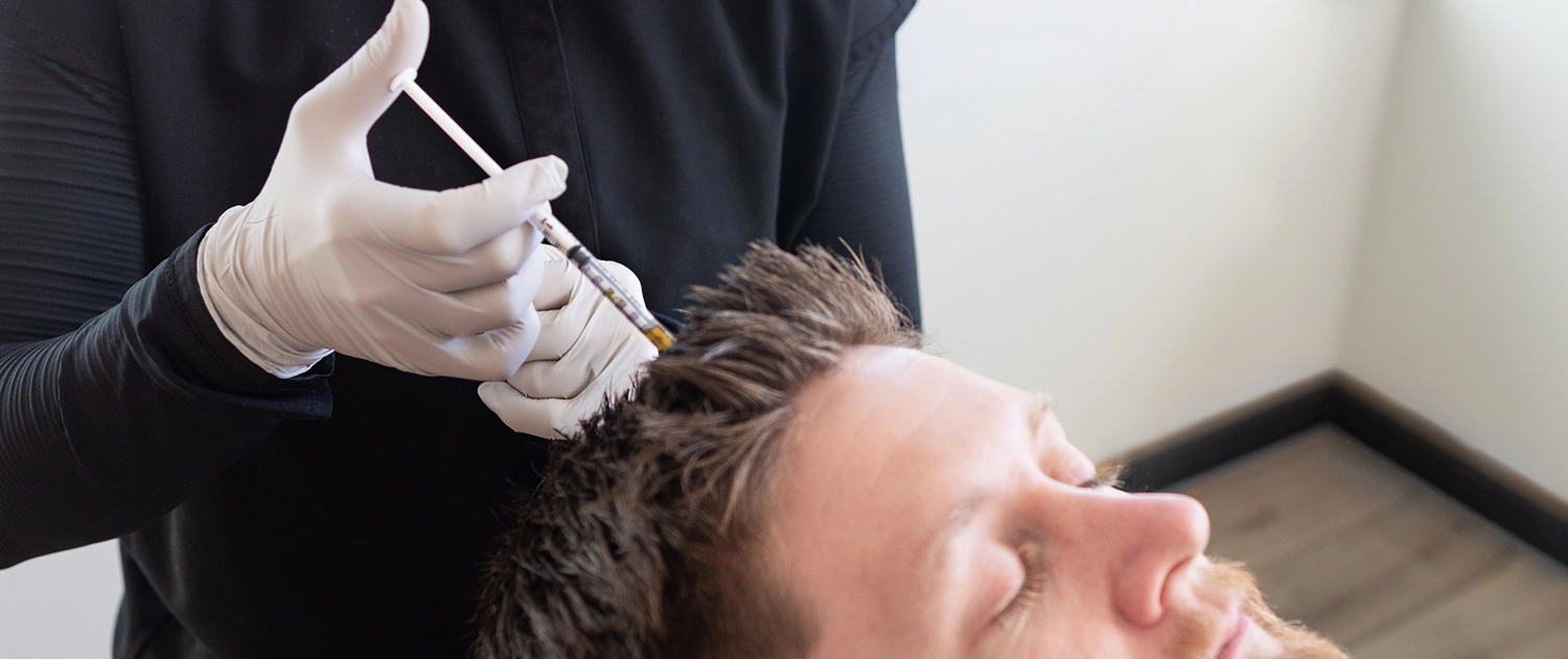 KAL-Body-HairRestoration