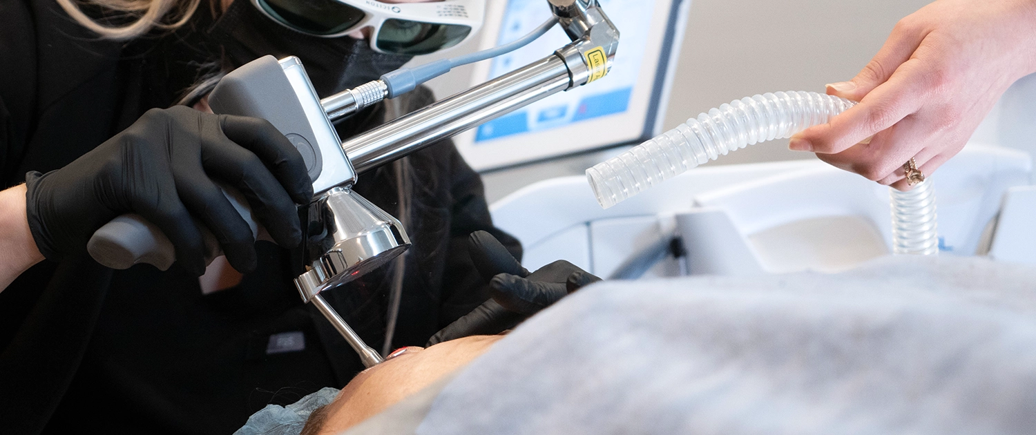 KAL-Body-Scar-Treatment
